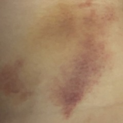 CollapsX - birthday man