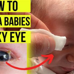 Best Treatment For Sticky Eyes In Newborn Reviews