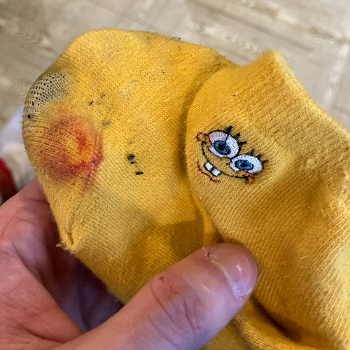 Blood on the SpongeBob Socks