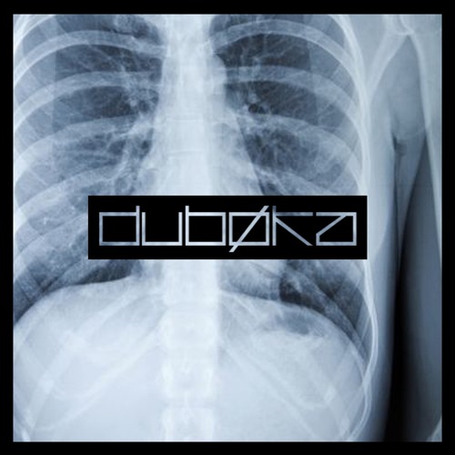DBKA083 - Chiodan