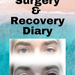 READ KINDLE 💓 Eyelift Surgery and Recovery Diary: Ptosis, eyelifts, punctal plugs, a