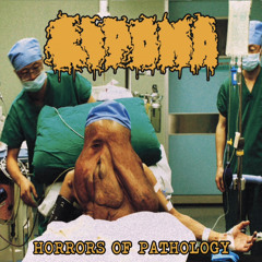 Lipoma - The Dark Art Of Necropsy