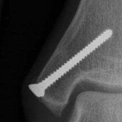 Roman Kaschuba - Fragmente