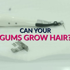 Can Your Gums Grow Hair Answer: Yes!