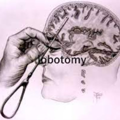 GVNDUBZ - lobotomy.