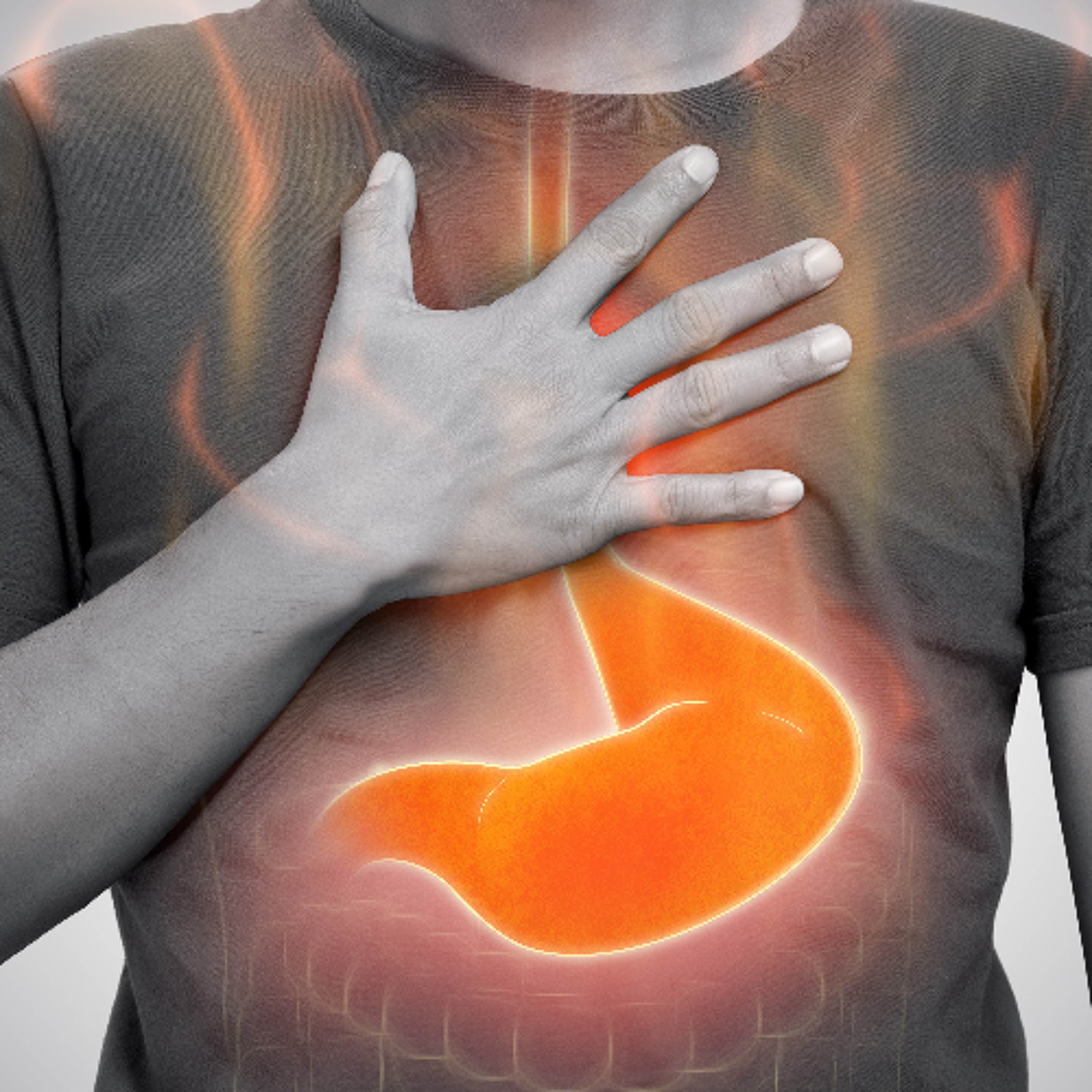 Episode #137 - The Lowdown on Upper GI Reflux Conditions episode artwork