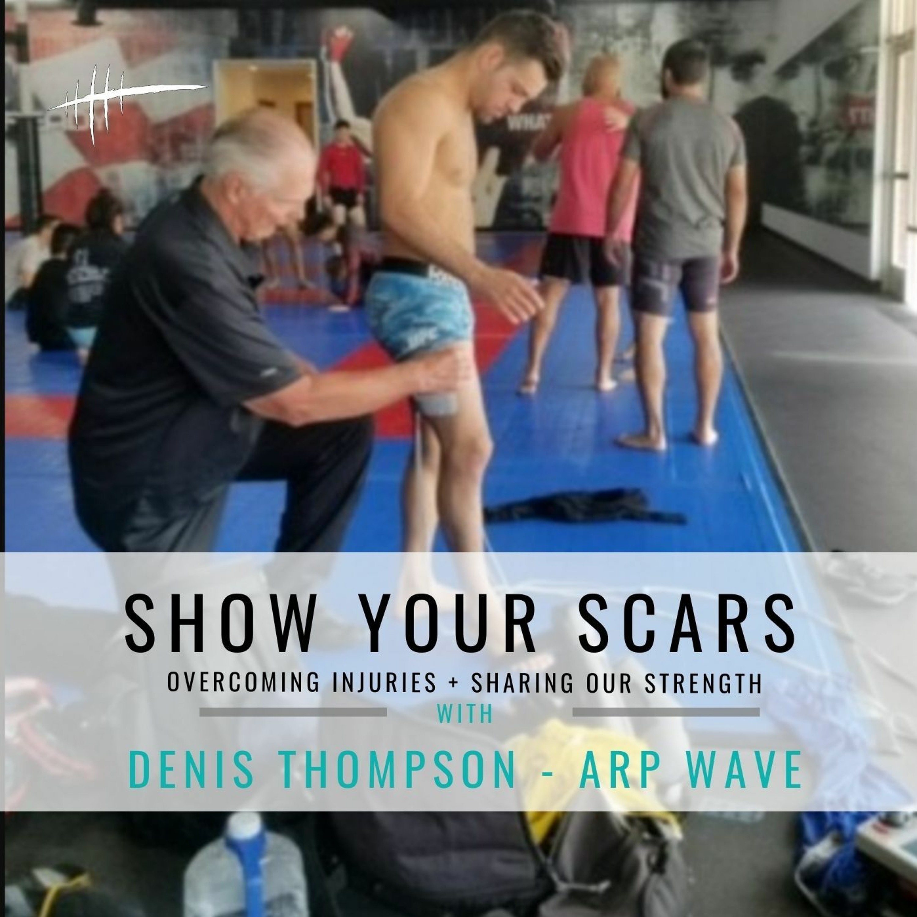 Show Your Scars