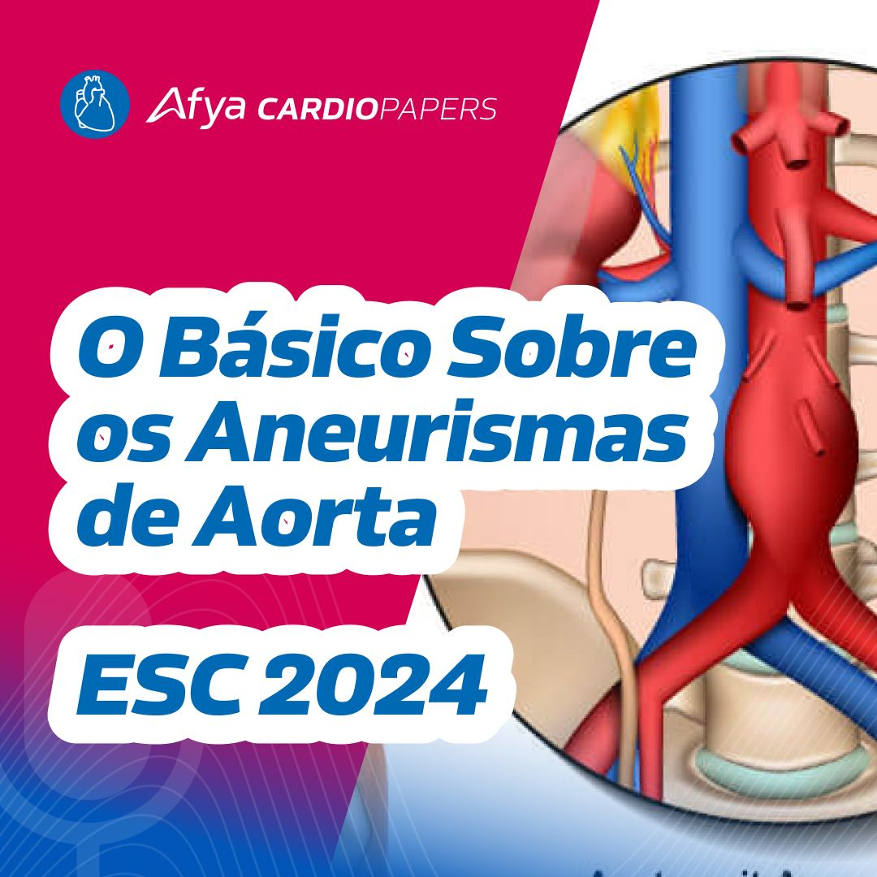 O básico sobre os aneurismas de aorta - Diretriz ESC 2024 episode artwork