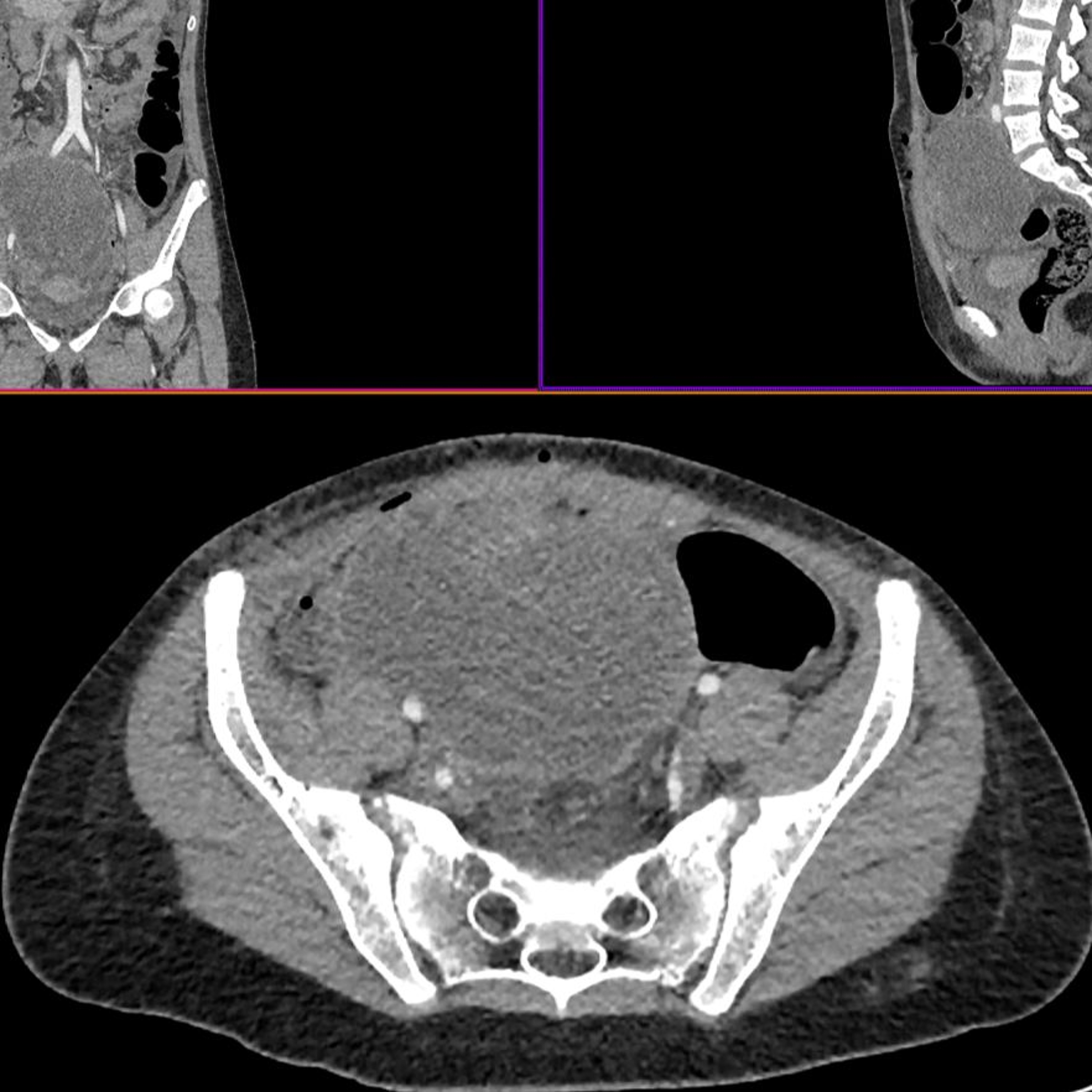 Oncotarget
