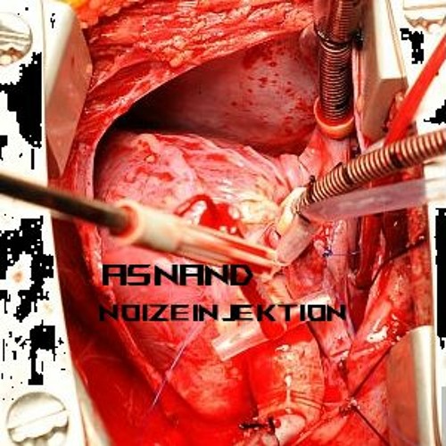Noize Injektion