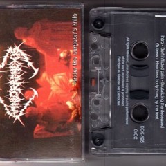 Amniorrehexis - Under The Surgeon’s Knife (Full Album)