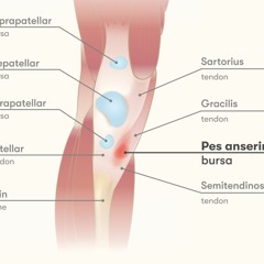Hur man hanterar bursit i ditt knä | Naprapat Kårell