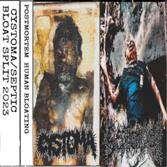 CYSTOMA / SEPTIC BLOAT SPLIT “POSTMORTEM HUMAN BLOATING” SEPTIC BLOAT SIDE