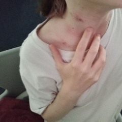 поцелуи на шее