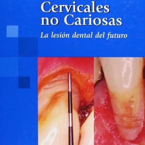 Download pdf Lesiones Cervicales no Cariosa: La lesión dental del futuro (Spanish Edition) by  Nél
