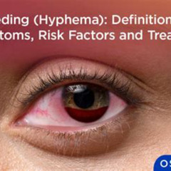 Best What Is The Treatment For Bleeding Behind Eye Reviews