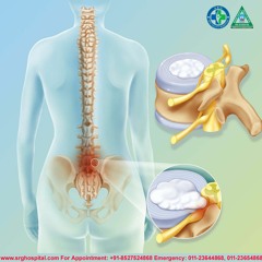 Spine Surgeon in Delhi Get consultation online