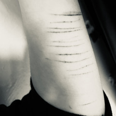 Deekay- Self Harm ft Suisside (Slowed Kiwi_rexo edit)