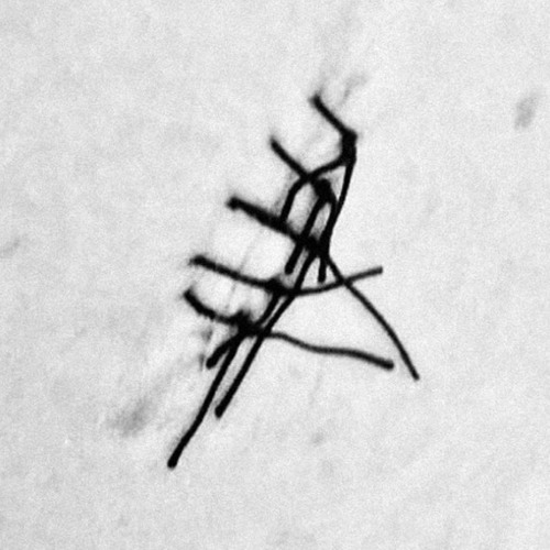 SÝN - Restos (2020)