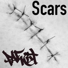 Scars