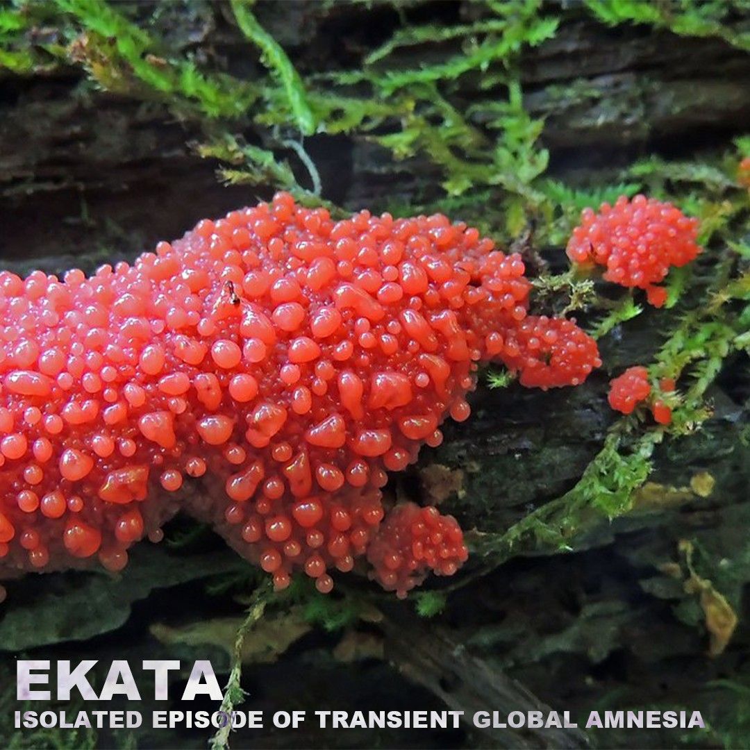 Hent Isolated Episode of Transient Global Amnesia | EKATA