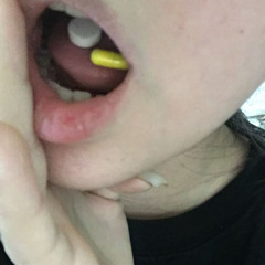 percs