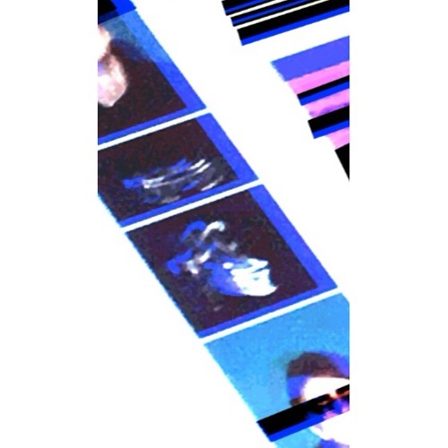 45 Prod. Keanbleed