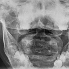 I can feel the thoughts dribble out of my head like lost blood