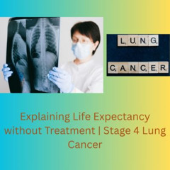 Explaining Life Expectancy without Treatment | Stage 4 Lung Cancer