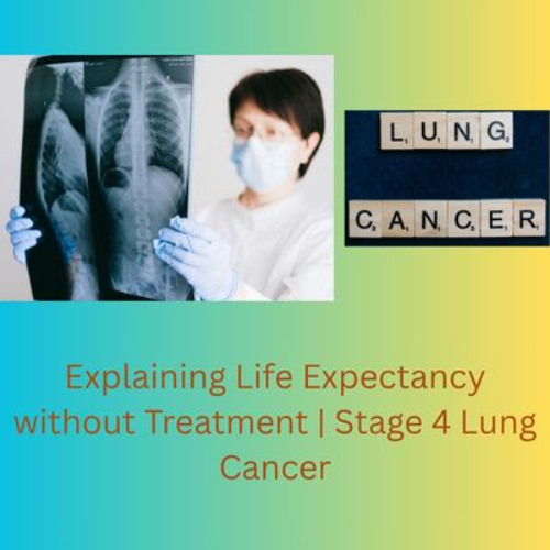 Explaining Life Expectancy without Treatment | Stage 4 Lung Cancer