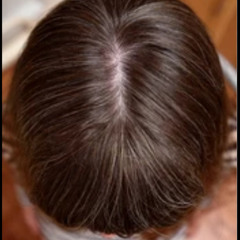 Those days prod. MUN