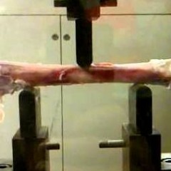 FEMUR BENT [FULL]