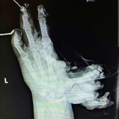 4Xtra FT Heres Johnny🤮🪓🇹🇹