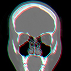 Intentional Disorder  - Live fucking off recording