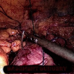 BASEMENT SURGERY