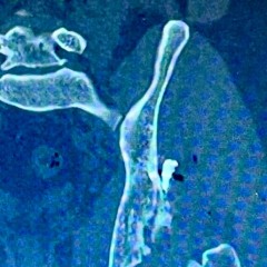 Lost In The Hospital (Original Mix)