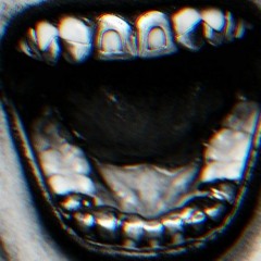 Actek - Porzellanzähne