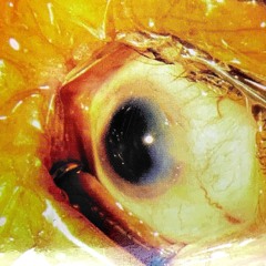 Drowning, Phone Calls