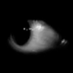 OPENUREYES