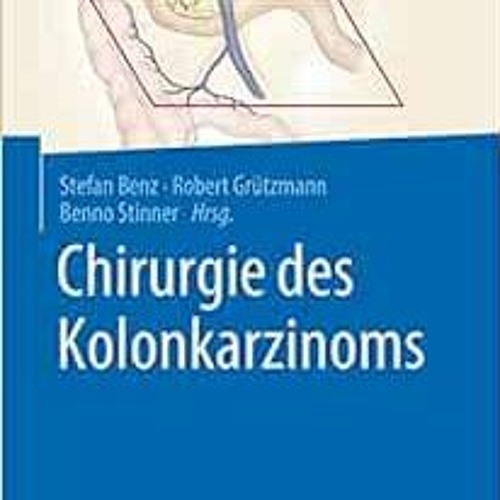 [Free] EPUB 📄 Chirurgie des Kolonkarzinoms (German Edition) by Stefan Benz,Robert Gr