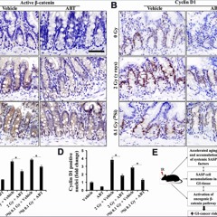 Senolytic ABT-263 Reduces Radiation-Induced Gastrointestinal Cancer