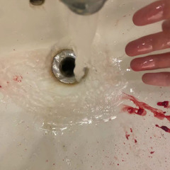 bleood - u like my skin