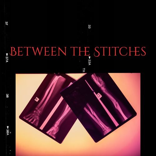 Between the Stitches