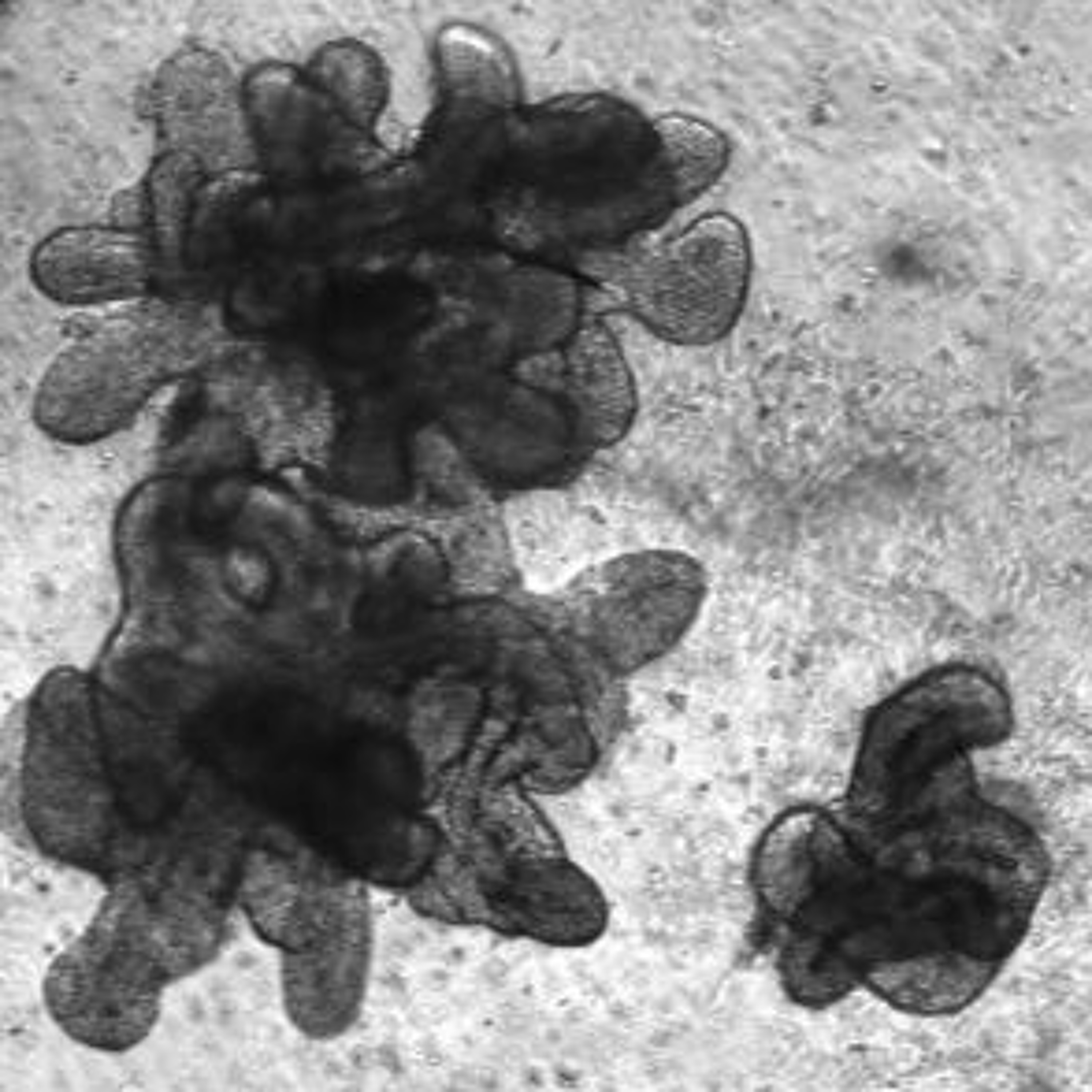 n=41 What mini-lungs in a dish might tell us about COVID-19