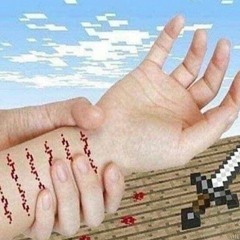 cuts on my wrist look like i got inna knife fight