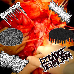 Intoxicated Adenomyosis (SIX WAY SPLIT) - SIDE CULOGRIND