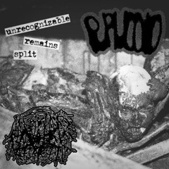 Cholelithiasis Discharge (Puruloid)