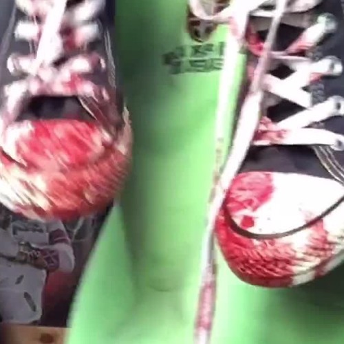 blood on my vans 😹🫵