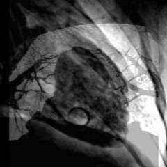 LostTakoTsubo_Experimental[NOISE]