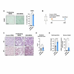 Human Senescent Fibroblasts Cause Lung Fibrosis in Mice